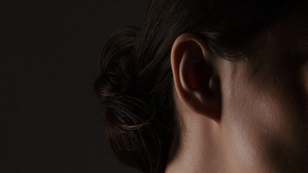 Otoplasty